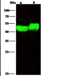 alpha-Galactosidase A/GLA Rabbit anti-Human, Clone: 201, Novus Biologicals