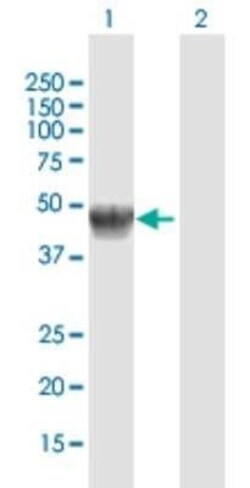 alpha-Galactosidase A/GLA Antibody, Novus Biologicals 0.1 mg | Buy Online | Novus Biologicals | Fisher Scientific