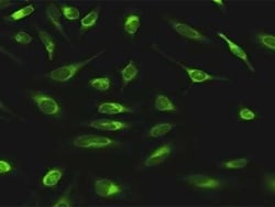 alpha Glucosidase 2 Antibody, Novus Biologicals 0.1 mg, Unconjugated:Antibodies,