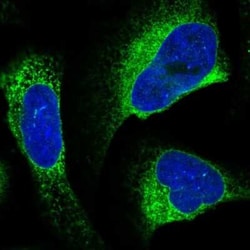 alpha Glucosidase 2 Antibody, Novus Biologicals:Antibodies:Primary Antibodies