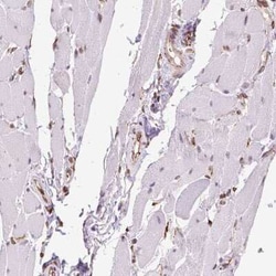 alpha Glucosidase 2 Antibody, Novus Biologicals:Antibodies:Primary Antibodies