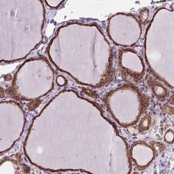 alpha Glucosidase 2 Antibody, Novus Biologicals:Antibodies:Primary Antibodies
