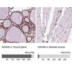 alpha Glucosidase 2 Antibody, Novus Biologicals:Antibodies:Primary Antibodies