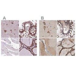 alpha Glucosidase 2 Antibody, Novus Biologicals:Antibodies:Primary Antibodies