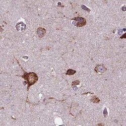 alpha Glucosidase 2 Antibody, Novus Biologicals:Antibodies:Primary Antibodies