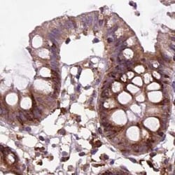 alpha Glucosidase 2 Antibody, Novus Biologicals:Antibodies:Primary Antibodies
