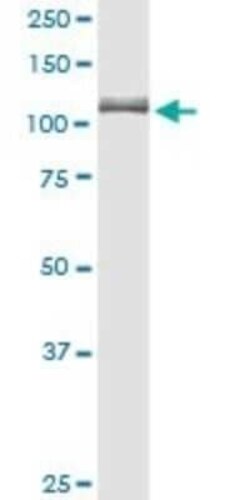 alpha Glucosidase 2 Antibody, Novus Biologicals 0.1 mg, Unconjugated:Antibodies,