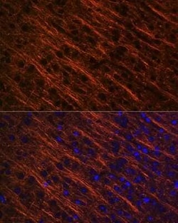 alpha-Internexin Rabbit anti-Human, Mouse, Rat, Clone: 5E5Z3, Novus Biologicals