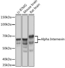 alpha-Internexin Rabbit anti-Human, Mouse, Rat, Clone: 5E5Z3, Novus Biologicals