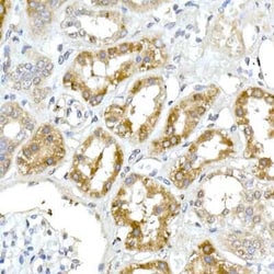 alpha-Methylacyl-CoA Racemase/AMACR Rabbit anti-Human, Mouse, Rat, Clone: