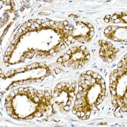 alpha-Methylacyl-CoA Racemase/AMACR Rabbit anti-Human, Mouse, Rat, Clone: