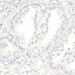 alpha-Methylacyl-CoA Racemase/AMACR Rabbit anti-Human, Mouse, Rat, Clone: