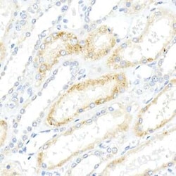 alpha-Methylacyl-CoA Racemase/AMACR Rabbit anti-Human, Mouse, Rat, Clone: