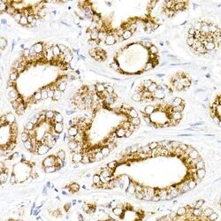 alpha-Methylacyl-CoA Racemase/AMACR Rabbit anti-Human, Mouse, Rat, Clone: