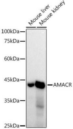 alpha-Methylacyl-CoA Racemase/AMACR Rabbit anti-Human, Mouse, Rat, Clone: