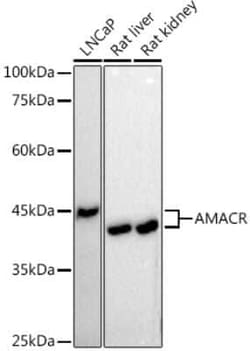 alpha-Methylacyl-CoA Racemase/AMACR Rabbit anti-Human, Mouse, Rat, Clone: