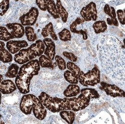 alpha-Methylacyl-CoA Racemase/AMACR Antibody (CL9362), Novus Biologicals