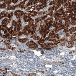 alpha-Methylacyl-CoA Racemase/AMACR Antibody (CL9362), Novus Biologicals