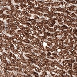 alpha-Methylacyl-CoA Racemase/AMACR Antibody (CL9362), Novus Biologicals