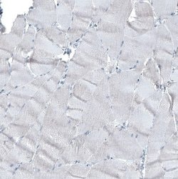 alpha-Methylacyl-CoA Racemase/AMACR Antibody (CL9362), Novus Biologicals
