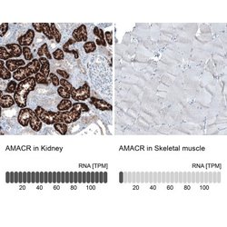 alpha-Methylacyl-CoA Racemase/AMACR Antibody (CL9362), Novus Biologicals