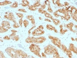 alpha-Methylacyl-CoA Racemase/AMACR Antibody (AMACR/1723), Novus Biologicals