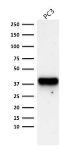 alpha-Methylacyl-CoA Racemase/AMACR Antibody (AMACR/1723), Novus Biologicals