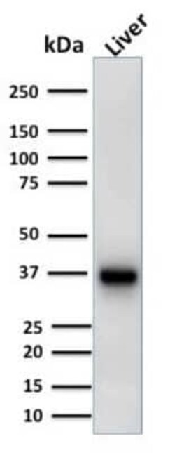 alpha-Methylacyl-CoA Racemase/AMACR Antibody (AMACR/1723), Novus Biologicals