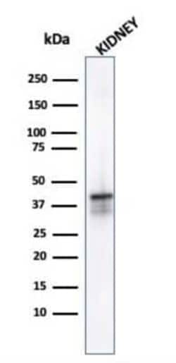 alpha-Methylacyl-CoA Racemase/AMACR Antibody (AMACR/1723), Novus Biologicals