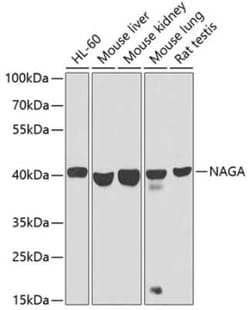 alpha-N-acetylgalactosaminidase/NAGA Antibody - BSA Free, Novus Biologicals