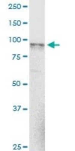 alpha-N-acetylglucosaminidase/NAGLU Antibody (1B7), Novus Biologicals 0.1 mg | Buy Online | Novus Biologicals | Fisher Scientific