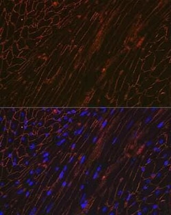 alpha-Sarcoglycan Rabbit anti-Human, Mouse, Rat, Clone: 3W3Q10, Novus Biologicals:Antibodies:Primary