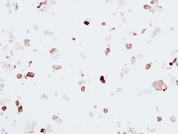 alpha-Smooth Muscle Actin Antibody (BLR082G), Novus Biologicals 100 &mu;L;