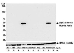 alpha-Smooth Muscle Actin Antibody (BLR082G), Novus Biologicals 100 &mu;L;