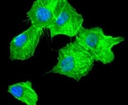 alpha-Smooth Muscle Actin Antibody (SY02-64), Novus Biologicals 100&mu;L:Antibodies,