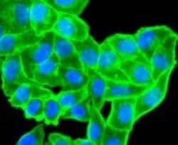 alpha-Smooth Muscle Actin Antibody (SY02-64), Novus Biologicals 100&mu;L:Antibodies,