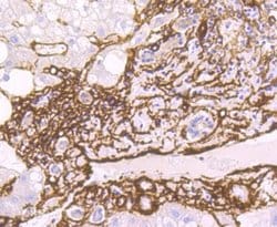 alpha-Smooth Muscle Actin Antibody (SY02-64), Novus Biologicals 100&mu;L:Antibodies,