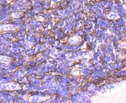 alpha-Smooth Muscle Actin Antibody (SY02-64), Novus Biologicals 100&mu;L:Antibodies,