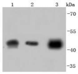 alpha-Smooth Muscle Actin Antibody (SY02-64), Novus Biologicals 100&mu;L:Antibodies,