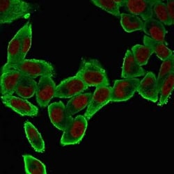 alpha-Smooth Muscle Actin Antibody (ACTA2/791), Novus Biologicals:Antibodies:Primary