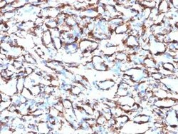 alpha-Smooth Muscle Actin Antibody (ACTA2/791), Novus Biologicals:Antibodies:Primary