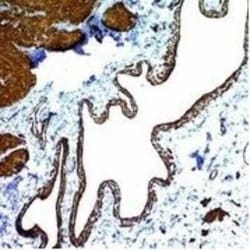 alpha-Smooth Muscle Actin Antibody (ACTA2/791), Novus Biologicals:Antibodies:Primary