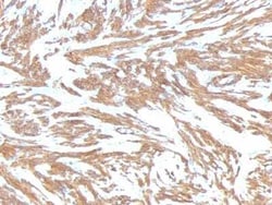 alpha-Smooth Muscle Actin Antibody (ACTA2/791), Novus Biologicals:Antibodies:Primary