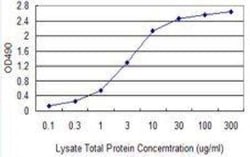 alpha-Smooth Muscle Actin Antibody Pair, Novus Biologicals 1 Set, Unconjugated:Antibodies,
