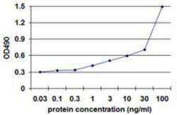 alpha-Smooth Muscle Actin Antibody Pair, Novus Biologicals 1 Set, Unconjugated:Antibodies,