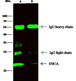 alpha-Synuclein Rabbit anti-Human, Clone: 17, Novus Biologicals 50 &mu;g | Buy Online | Novus Biologicals | Fisher Scientific