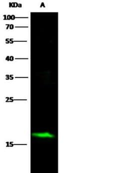alpha-Synuclein Rabbit anti-Human, Clone: 17, Novus Biologicals 50 &mu;g | Buy Online | Novus Biologicals | Fisher Scientific