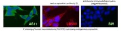 alpha-Synuclein Antibody (AS11), Novus Biologicals 0.1mg; Unlabeled:Antibodies,