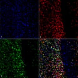 alpha-Synuclein, p Ser129 Antibody, Novus Biologicals:Antibodies:Primary