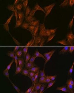 alpha Tubulin 4a Rabbit anti-Human, Mouse, Rat, Clone: 1K6U1, Novus Biologicals 100 &mu;g | Buy Online | Novus Biologicals | Fisher Scientific